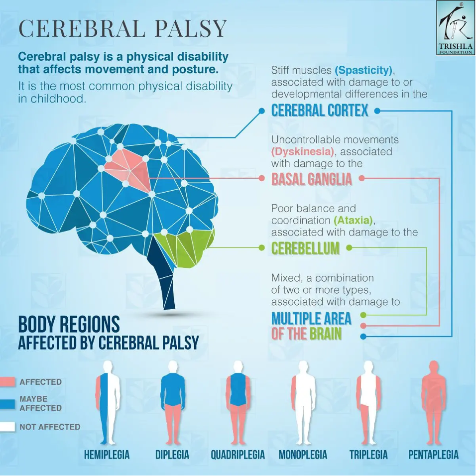 Cerebral palsy diagram of the brain