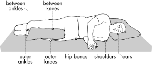 Graph Areas Especially Susceptible to Pressure Injury