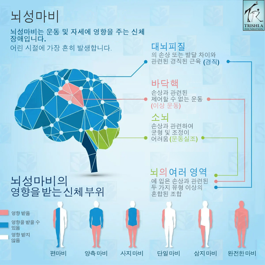 Graphic of brain and effects of cerebral palsy